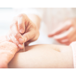 Low abdomen acupuncture treating AMH Anti-Mullerian Hormone levels in Vancouver
