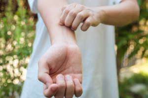 Itchy wrist treatment with Foxglove plant Chinese Medicine in Vancouver