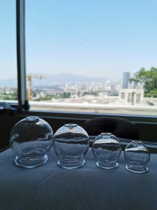 Cupping Cups on treatment table at Bodahealth in Vancouver