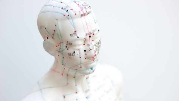 Acupuncture Model - Acupuncture in Vancouver
