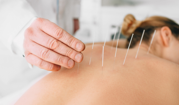Upper back acupuncture in Vancouver at BodaHealth